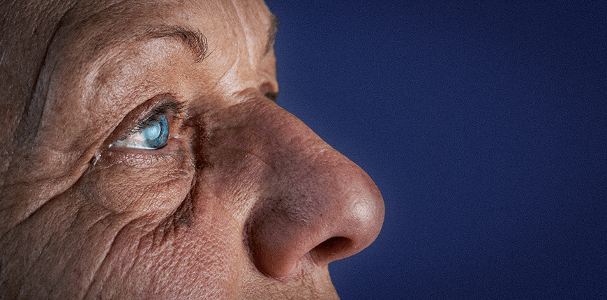 Cataract Surgery