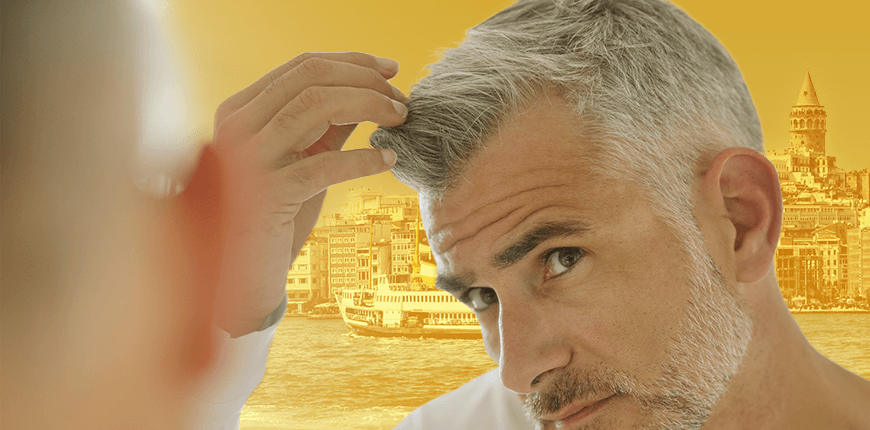 Don’t Spend a Fortune On Hair Restoration!