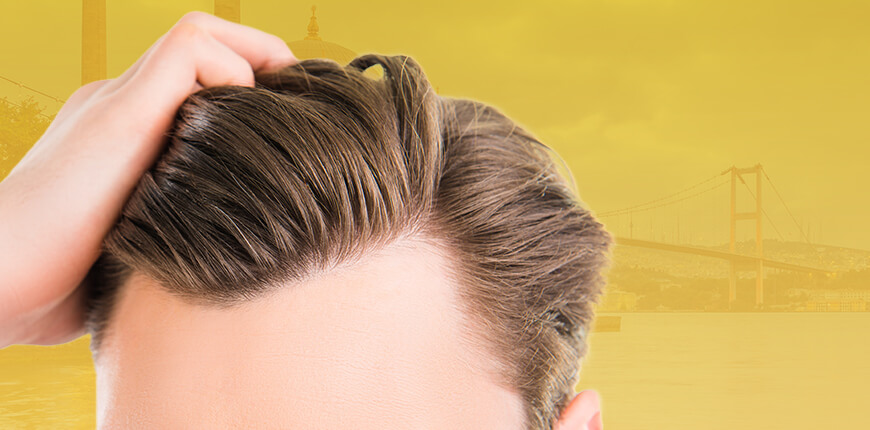 Hair Restoration Journey's Seven Stages