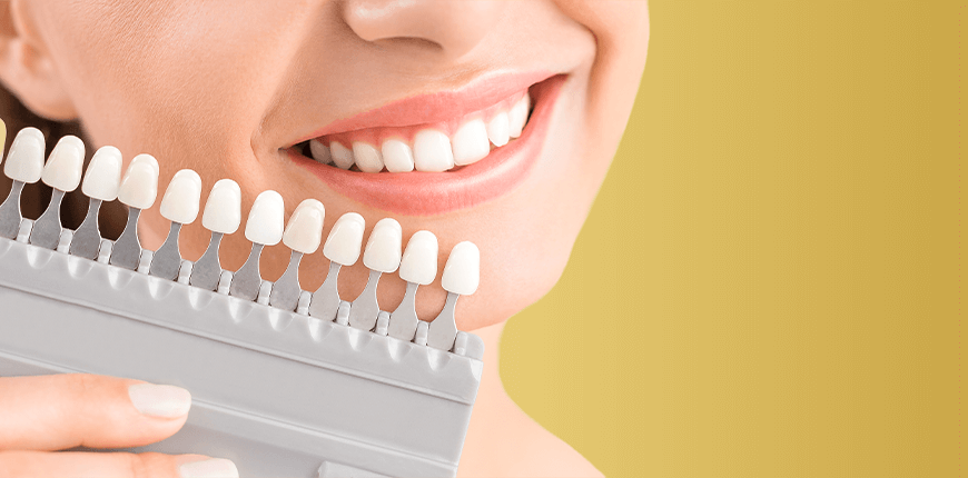 Why Dental Implant is Performed?
