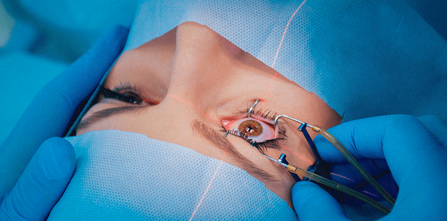 Laser Eye Treatments